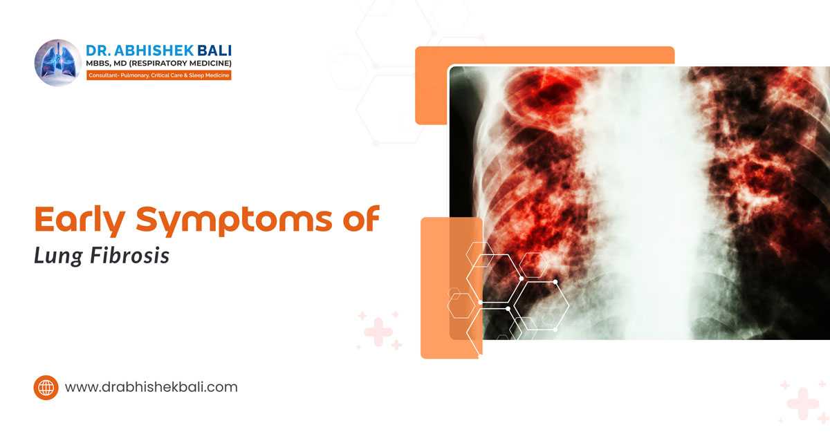 Early symptoms of lung fibrosis showing lung scarring on chest X-ray, explained by Dr. Abhishek Bali, Pulmonologist and Respiratory Specialist in Siliguri