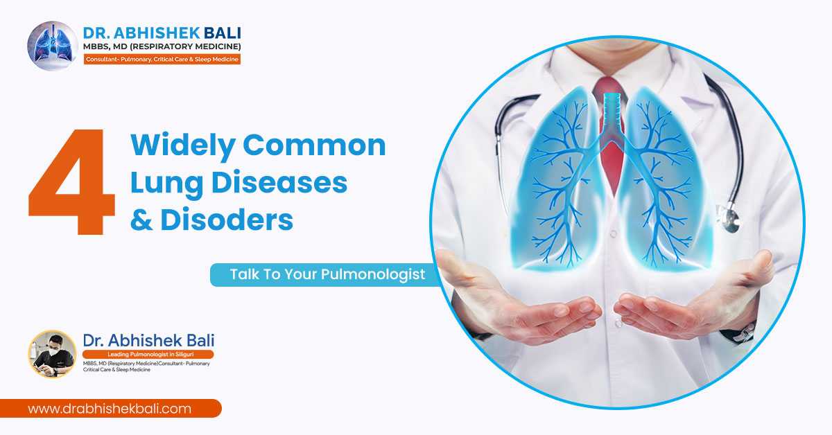 Consult The Best Pulmonologist in Siliguri-Dr Abhishek Bali