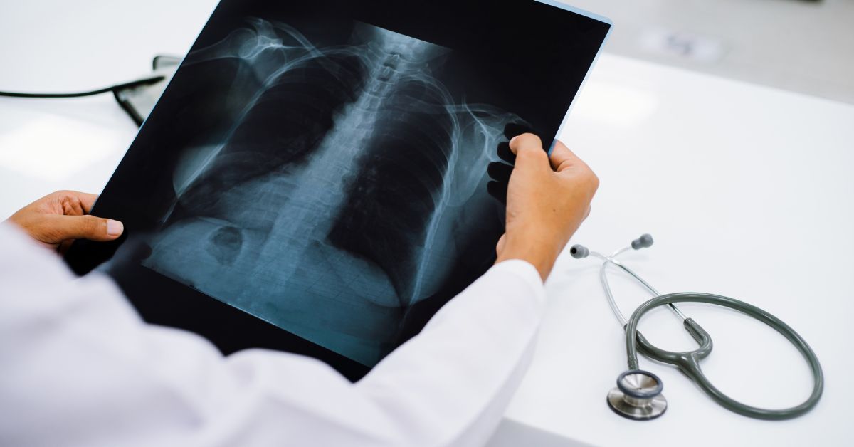 chest doctor