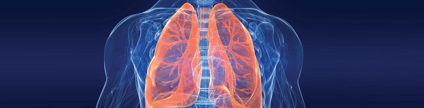 Interstitial Lung Disease