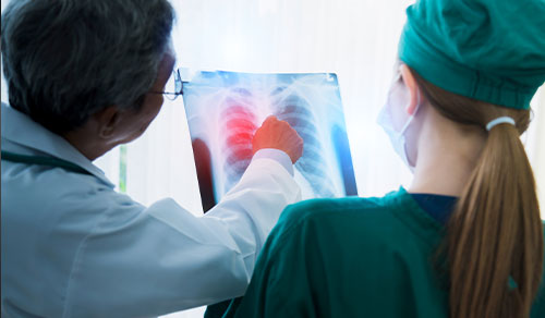 Ventilator Management
