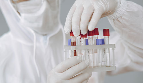 Molecular Tests