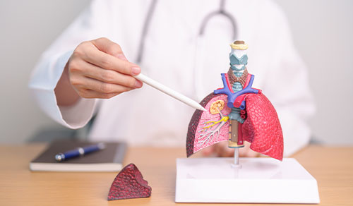 Pleural Biopsy