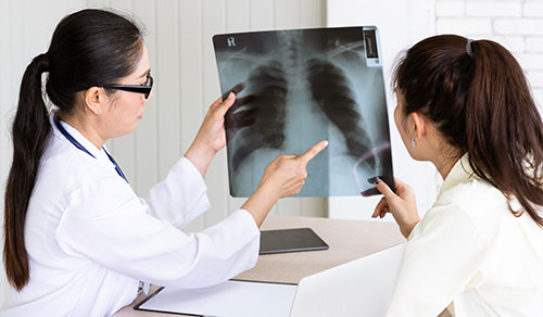 Severe Pneumonia