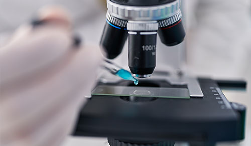Sputum Smear Microscopy