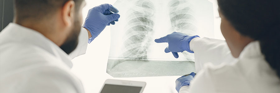 Tuberculosis Treatment in Siliguri